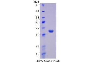 SDS-PAGE analysis of Mouse Interferon alpha 13 Protein. (IFNA13 蛋白)