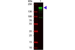 Image no. 1 for anti-alpha-2-Macroglobulin (A2M) antibody (ABIN799706) (alpha 2 Macroglobulin 抗体)