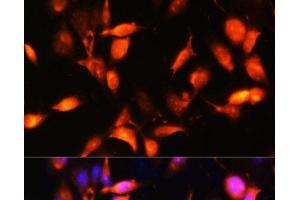 Immunofluorescence (IF) image for anti-ADP-Ribosylation Factor-Like 4A (ARL4A) antibody (ABIN7259554)
