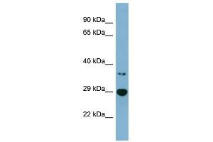 BDH2 antibody used at 1 ug/ml to detect target protein. (BDH2 抗体  (Middle Region))