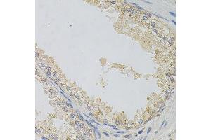 Immunohistochemistry of paraffin-embedded human prostate using NAPA antibody. (NAPA 抗体)