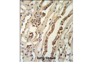 GMNN Antibody (Center ) (ABIN651420 and ABIN2840228) IHC analysis in formalin fixed and paraffin embedded lung tissue followed by peroxidase conjugation of the secondary antibody and DAB staining. (Geminin 抗体  (AA 96-123))