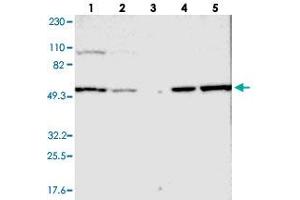 Western blot analysis of Lane 1: RT-4, Lane 2: U-251 MG, Lane 3: Human Plasma, Lane 4: Liver, Lane 5: Tonsil with LMAN1 polyclonal antibody . (LMAN1 抗体)