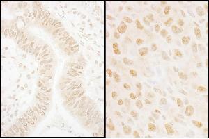 anti-SSB1 (AA 161-211) antibody