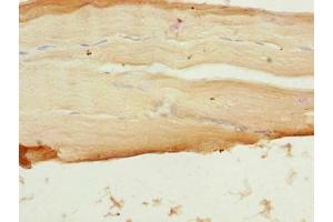 Immunohistochemistry of paraffin-embedded human skeletal muscle tissue using ABIN7169591 at dilution of 1:100 (Sideroflexin 4 抗体  (AA 2-110))