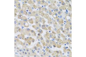 Immunohistochemistry of paraffin-embedded human liver injury using SNAP29 antibody. (SNAP29 抗体)