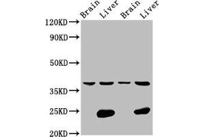 Western Blot Positive WB detected in: Rat brain tissue, Rat liver tissue, Mouse brain tissue, Mouse liver tissue All lanes: LSAMP antibody at 4. (LSAMP 抗体  (AA 168-287))