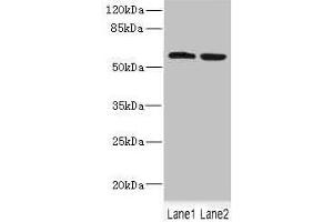 Western blot All lanes: FTCD antibody at 5. (FTCD 抗体  (AA 412-541))