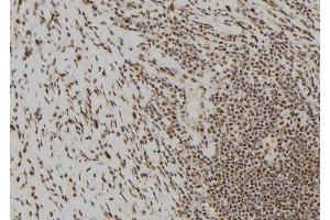 ABIN6277474 at 1/100 staining Human gastric tissue by IHC-P. (DUSP6 抗体  (C-Term))