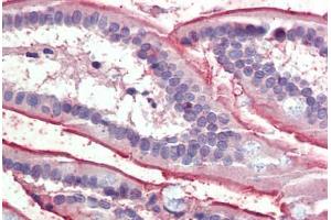 Small intestine, Human: Formalin-Fixed, Paraffin-Embedded (FFPE) (SLC5A1 抗体  (AA 458-472))