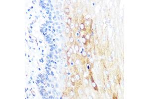 Immunohistochemistry of paraffin-embedded human esophageal using ROCK2 Rabbit mAb (ABIN7269972) at dilution of 1:100 (40x lens). (ROCK2 抗体)
