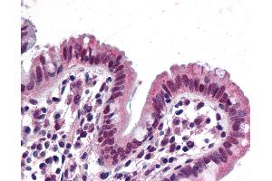 Immunohistochemistry (IHC) image for anti-SWI/SNF Related, Matrix Associated, Actin Dependent Regulator of Chromatin, Subfamily B, Member 1 (SMARCB1) (AA 81-181) antibody (ABIN790482)