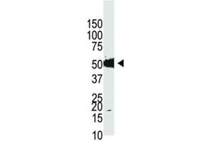 Western blot analysis of Dnmt2 antibody and HL-60 cell lysate (Dnmt2 抗体  (AA 201-230))