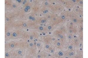 Detection of SP140 in Human Liver Tissue using Polyclonal Antibody to Sp140 Nuclear Body Protein (SP140) (SP140 抗体  (AA 443-655))