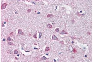 Human Brain, Cortex (formalin-fixed, paraffin-embedded) stained with NF2 antibody ABIN337064 at 5 ug/ml followed by biotinylated anti-goat IgG secondary antibody ABIN481715, alkaline phosphatase-streptavidin and chromogen. (Merlin 抗体  (AA 526-536))