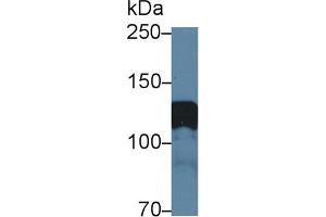 Western Blotting (WB) image for anti-Amphiphysin (AMPH) (AA 24-240) antibody (ABIN7444721)