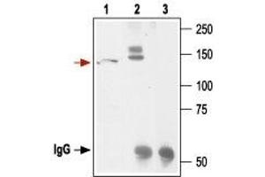 Immunoprecipitation of the lysate of HEK 293 cells, stably expressing HERG with Anti-KCNH2 (erg1) Antibody (ABIN7043543, ABIN7044916 and ABIN7044917): - 1.