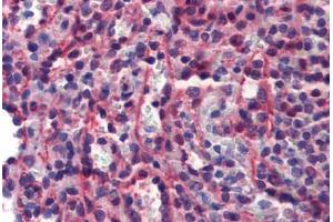 Human Spleen (formalin-fixed, paraffin-embedded) stained with CASP7 antibody ABIN462356 followed by biotinylated anti-mouse IgG secondary antibody ABIN481714, alkaline phosphatase-streptavidin and chromogen. (Caspase 7 抗体)