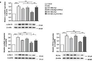 Western Blotting (WB) image for anti-Proliferating Cell Nuclear Antigen (PCNA) (AA 201-261) antibody (ABIN676598)