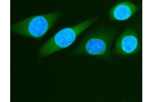 IF analysis of ALDH1A3 using anti-ALDH1A3 antibody (ABIN5518802).