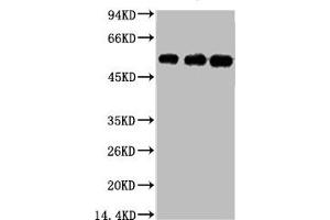 Western blot analysis of 1) Hela, 2) Mouse Brain tissue, 3) Rat Brain tissue, diluted at 1:5000. (TUBB3 抗体)