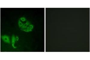 Immunofluorescence analysis of A549 cells, using GPR20 Antibody. (GPR20 抗体  (AA 291-340))