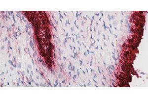 Frozen human synovial tissue section from patient with osteoarthritis was stained with hematoxylin and eosin and Mouse Anti-Human CD55-UNLB followed by a secondary antibody and colorimetric substrate. (CD55 抗体)