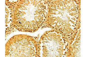 ABIN6263677 and ABIN6273060 at 1/100 staining Rat testis tissue by IHC-P.