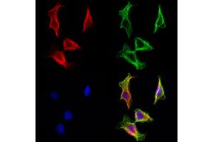 ABIN6263468 and ABIN6272966 staining Hela cells by IF/ICC. (MYH7 抗体  (C-Term))
