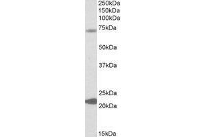 Western Blotting (WB) image for anti-Potassium Intermediate/small Conductance Calcium-Activated Channel, Subfamily N, Member 2 (KCNN2) (Internal Region) antibody (ABIN2464352) (KCNN2 抗体  (Internal Region))