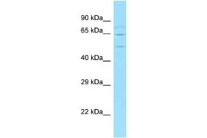 WB Suggested Anti-Wasf2 Antibody   Titration: 1. (WASF2 抗体  (Middle Region))