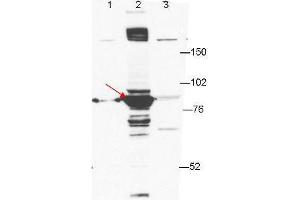 Anti-ESRP-1 by western blot shows detection of ESRP-1 in transfected 293T cell extracts (lane 2, arrowhead). (ESRP1 抗体)