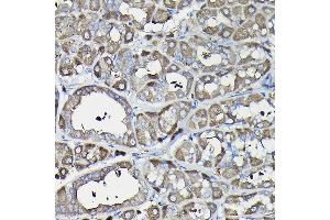 Immunohistochemistry (IHC) image for anti-Ferritin, Heavy Polypeptide 1 (FTH1) (AA 1-183) antibody (ABIN3021539)
