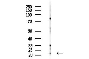anti-DIRAS Family, GTP-Binding RAS-Like 1 (DIRAS1) (C-Term) antibody