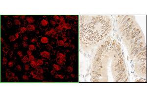 Immunohistochemistry (IHC) image for anti-N(alpha)-Acetyltransferase 15, NatA Auxiliary Subunit (NAA15) (AA 816-866) antibody (ABIN7455236)