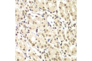 Immunohistochemistry of paraffin-embedded human gastric using ULK4 antibody (ABIN5975557) at dilution of 1/100 (40x lens). (ULK4 抗体)