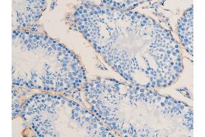 ABIN6267068 at 1/100 staining mouse testis tissue sections by IHC-P. (Smooth Muscle Actin 抗体  (N-Term))