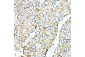 Immunohistochemistry (IHC) image for anti-Heat Shock Protein 90kDa beta (Grp94), Member 1 (HSP90B1) (AA 550-650) antibody (ABIN6142031)
