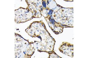 Immunohistochemistry of paraffin-embedded human placenta using TLR3 Rabbit pAb (ABIN6130066, ABIN6149219, ABIN6149220 and ABIN6215465) at dilution of 1:100 (40x lens). (TLR3 抗体  (AA 464-647))