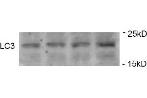 Immunoblots of SH-SY5Y cells treated with P+ for 24h was probed with (ABIN389699 and ABIN2839660).