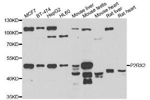Western blot analysis of extracts of various cell lines, using P2RX2 antibody. (P2RX2 抗体  (AA 60-320))