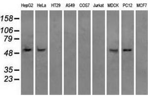 Western blot analysis of extracts (35 µg) from 9 different cell lines by using anti-ATP5B monoclonal antibody. (ATP5B 抗体)