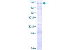 LAS1L Protein (AA 1-734) (GST tag)