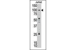 Western blot analysis of MLLT10 polyclonal antibody  in Jurkat cell lysate. (MLLT10 抗体  (C-Term))