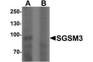 Western blot analysis of SGSM3 in 293 cell lysate with SGSM3 Antibody  at 1 ug/mL in (A) the absence and (B) the presence of blocking peptide. (SGSM3 抗体  (N-Term))