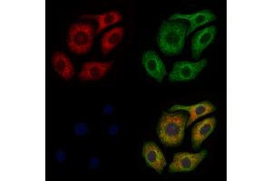ABIN6260299 and ABIN6277920 staining Hela cells by IF/ICC. (BSP 抗体  (Internal Region))