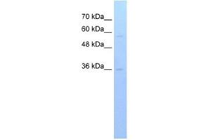 RFPL3 antibody used at 1 ug/ml to detect target protein. (RFPL3 抗体  (C-Term))