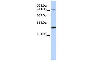 WB Suggested Anti-EDC4 Antibody Titration: 0. (EDC4 抗体  (N-Term))
