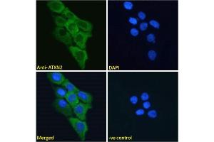 ABIN570879 Immunofluorescence analysis of paraformaldehyde fixed A431 cells, permeabilized with 0.