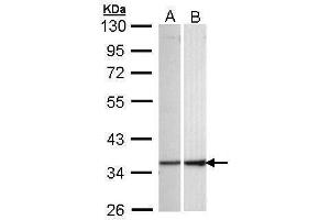 WB Image Sample (30 ug of whole cell lysate) A: 293T B: Hep G2 , 10% SDS PAGE antibody diluted at 1:1000